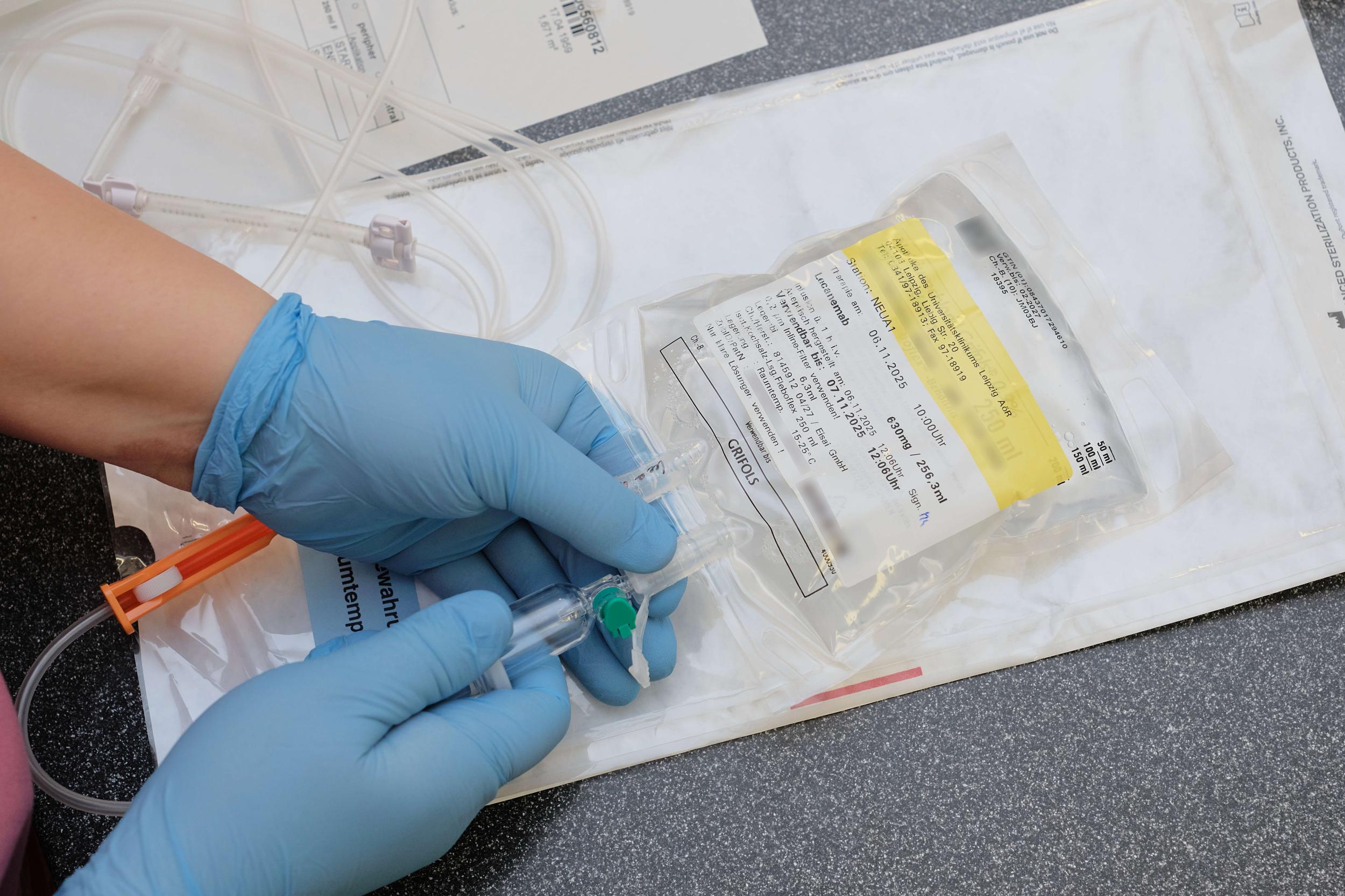 Behandschuhte Hände schließen einen Transfusionsbeutel mit Lecanemab an. 